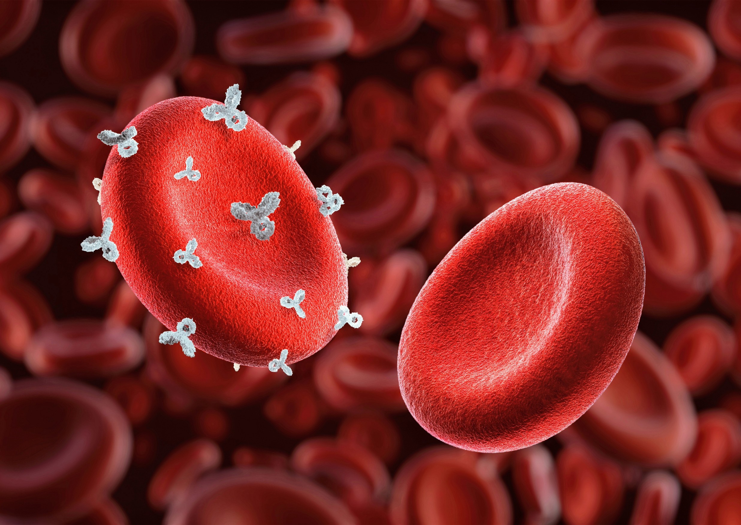 Could blood type determine your stroke risk?