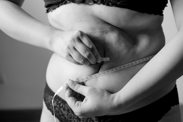 How to Combine Liposuction With a Healthy Lifestyle for Lasting Results 